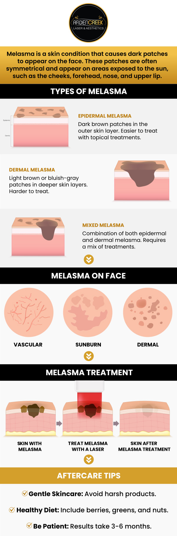 Common questions asked by clients: What is melasma? What causes melasma? Does melasma worsen with age? What are the types of melasma? How is melasma treated? For more information, contact us or schedule an appointment online. We are located at 1451 River Park Drive, Suite 210 Sacramento, CA 95815. We serve clients from Sacramento CA, North Natomas CA, Arden-Arcade CA, Lemon Hill CA, Florin CA, Fair Oaks CA, Rio Linda CA, Elk Grove CA, Citrus Heights CA, and surrounding areas. Common questions asked by clients: What is melasma? What causes melasma? Does melasma worsen with age? What are the types of melasma? How is melasma treated? For more information, contact us or schedule an appointment online. We are located at 1451 River Park Drive, Suite 210 Sacramento, CA 95815. We serve clients from Sacramento CA, North Natomas CA, Arden-Arcade CA, Lemon Hill CA, Florin CA, Fair Oaks CA, Rio Linda CA, Elk Grove CA, Citrus Heights CA, and surrounding areas.