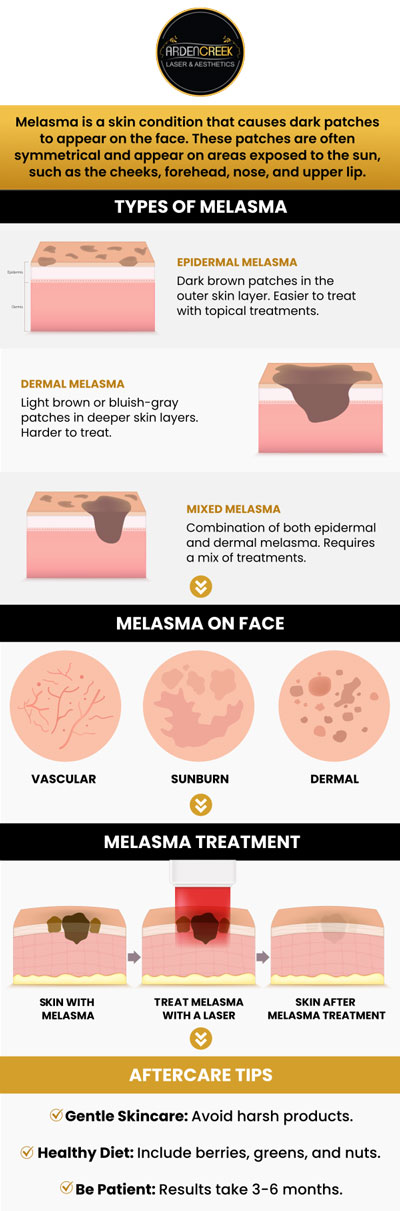 Common questions asked by clients: What is melasma? What causes melasma? Does melasma worsen with age? What are the types of melasma? How is melasma treated? For more information, contact us or schedule an appointment online. We are located at 1451 River Park Drive, Suite 210 Sacramento, CA 95815. We serve clients from Sacramento CA, North Natomas CA, Arden-Arcade CA, Lemon Hill CA, Florin CA, Fair Oaks CA, Rio Linda CA, Elk Grove CA, Citrus Heights CA, and surrounding areas. Common questions asked by clients: What is melasma? What causes melasma? Does melasma worsen with age? What are the types of melasma? How is melasma treated? For more information, contact us or schedule an appointment online. We are located at 1451 River Park Drive, Suite 210 Sacramento, CA 95815. We serve clients from Sacramento CA, North Natomas CA, Arden-Arcade CA, Lemon Hill CA, Florin CA, Fair Oaks CA, Rio Linda CA, Elk Grove CA, Citrus Heights CA, and surrounding areas.