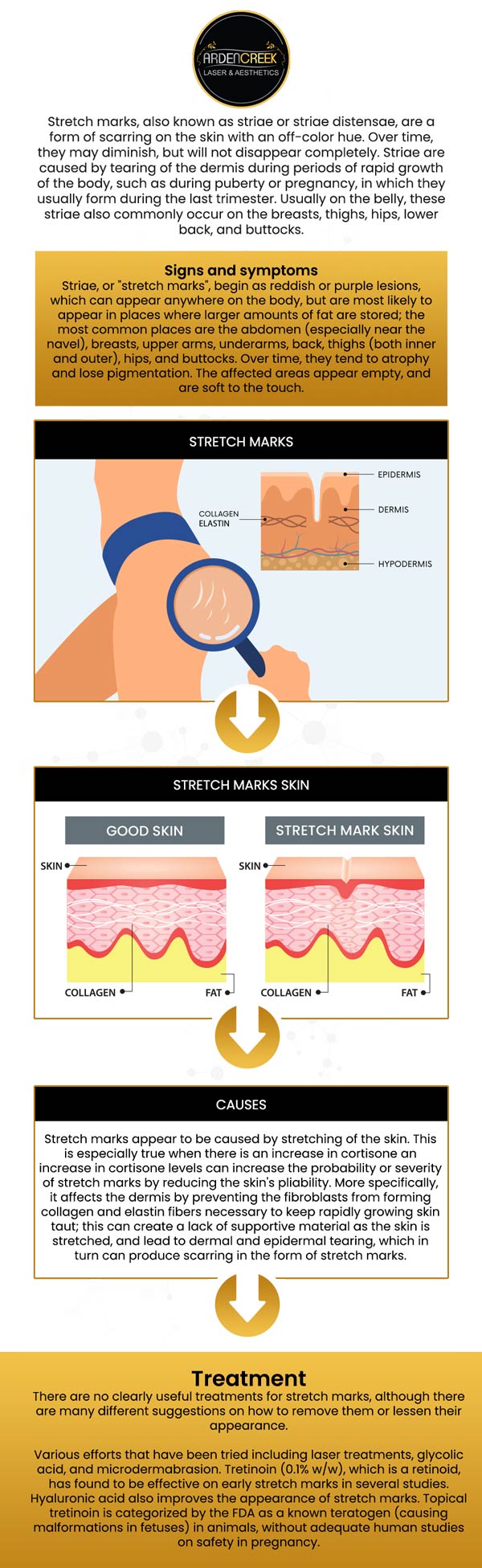 Common questions asked by clients: What is a stretch mark? What causes stretch marks? How are stretch marks treated? Can stretch marks be removed permanently? How much does it cost to remove a stretch mark? For more information, contact us or schedule an appointment online. We are located at 1451 River Park Drive, Suite 210 Sacramento, CA 95815. We serve clients from Sacramento CA, North Natomas CA, Arden-Arcade CA, Lemon Hill CA, Florin CA, Fair Oaks CA, Rio Linda CA, Elk Grove CA, Citrus Heights CA, and surrounding areas. Common questions asked by clients: What is a stretch mark? What causes stretch marks? How are stretch marks treated? Can stretch marks be removed permanently? How much does it cost to remove a stretch mark? For more information, contact us or schedule an appointment online. We are located at 1451 River Park Drive, Suite 210 Sacramento, CA 95815. We serve clients from Sacramento CA, North Natomas CA, Arden-Arcade CA, Lemon Hill CA, Florin CA, Fair Oaks CA, Rio Linda CA, Elk Grove CA, Citrus Heights CA, and surrounding areas.