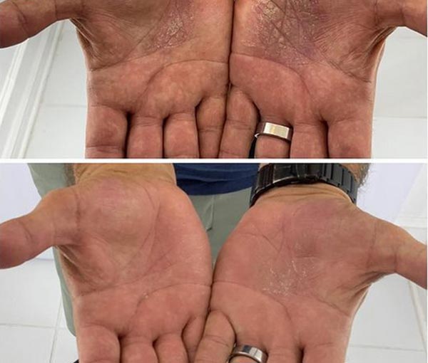 Before and After Images of Our Clients at Arden Creek Laser & Aesthetics in Sacramento, CA width=