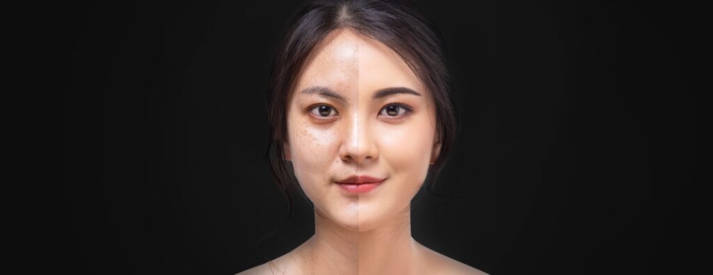 Our Results at Arden Creek Laser & Aesthetics, Med Spa 