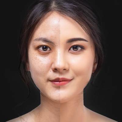 Our Results at Arden Creek Laser & Aesthetics, Med Spa 